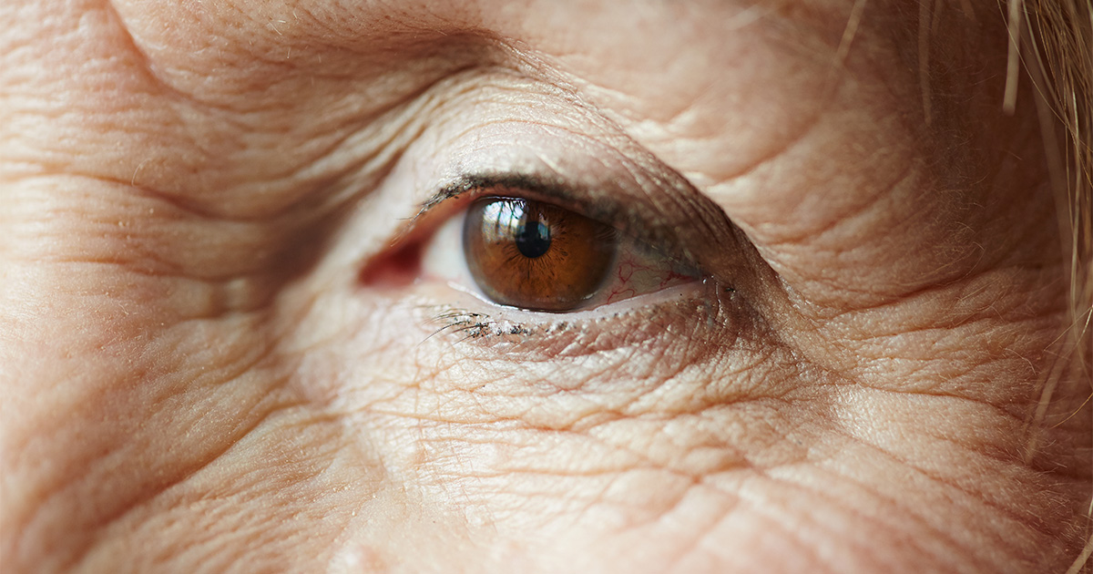 Mapeamento da retina pode indicar risco de Alzheimer