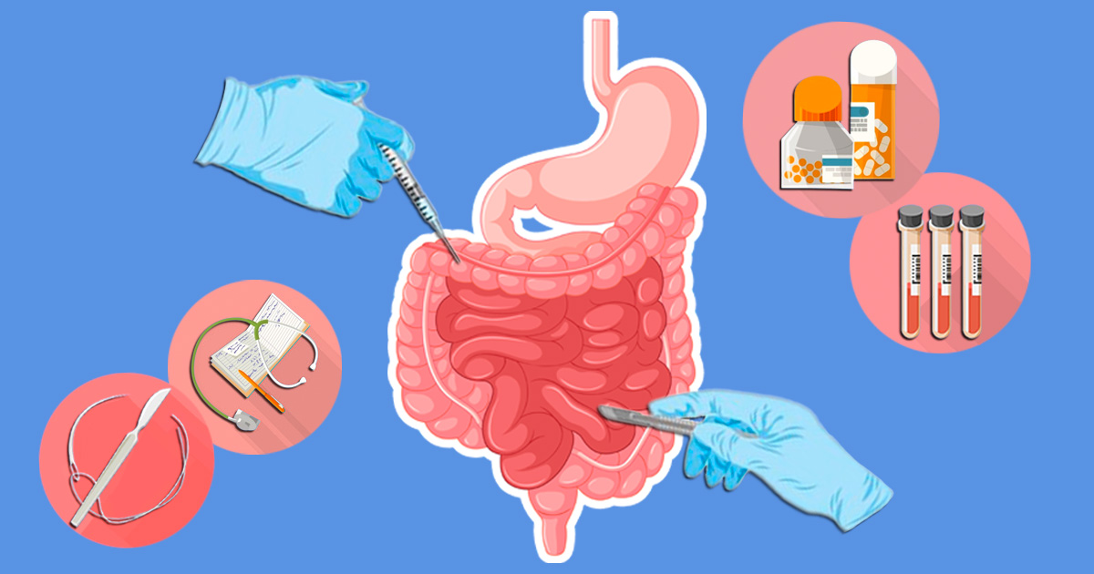 cirurgia bariátrica