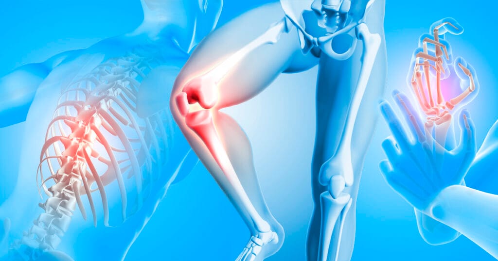 Laser de baixa intensidade melhora dor e qualidade de vida em pessoas com osteoartrite no joelho